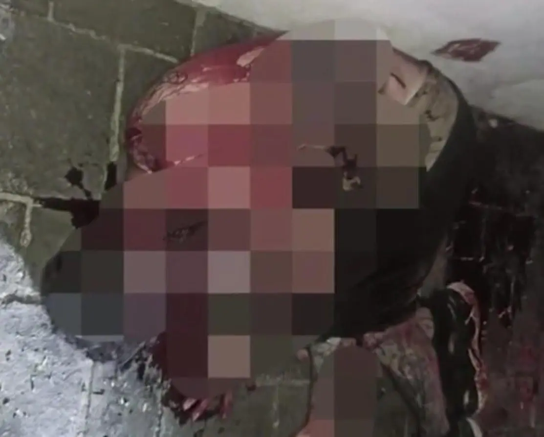 Aussie Man Gets Beaten, Stabbed Outside Nightclub In KL