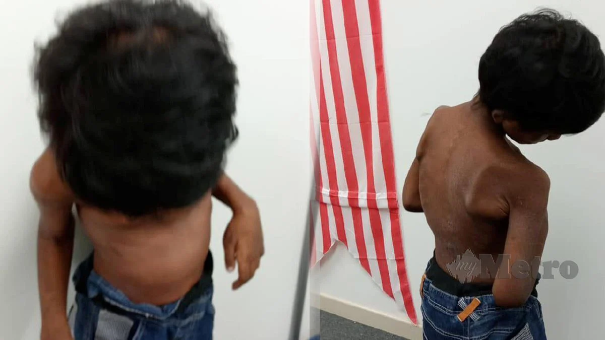 Navin Malaysian boy who got abused