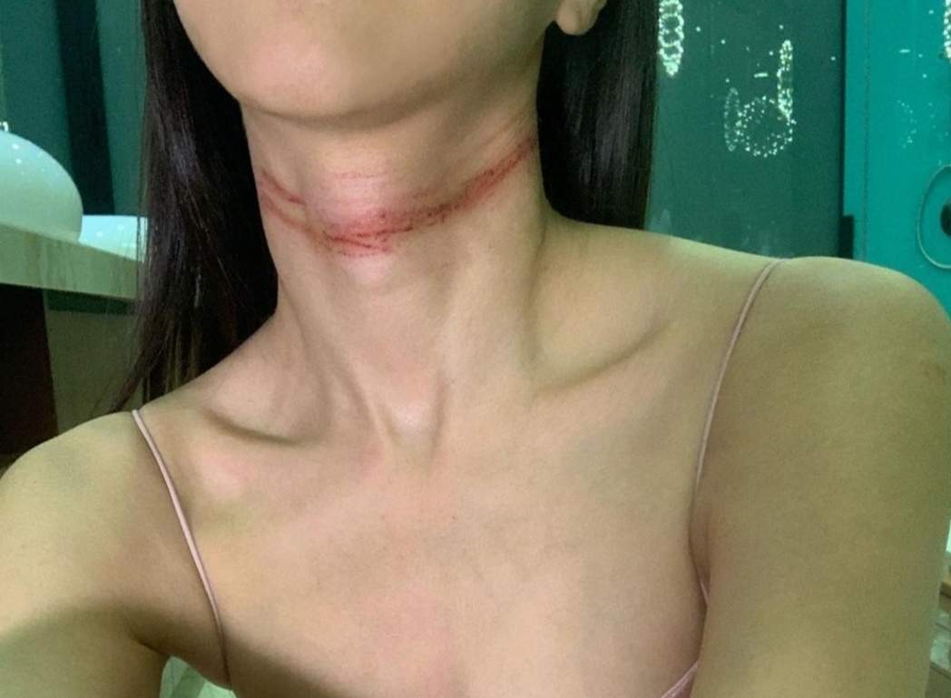 "I'm not perfect" Cathryn Lee attempts suicide over recent online criticisms