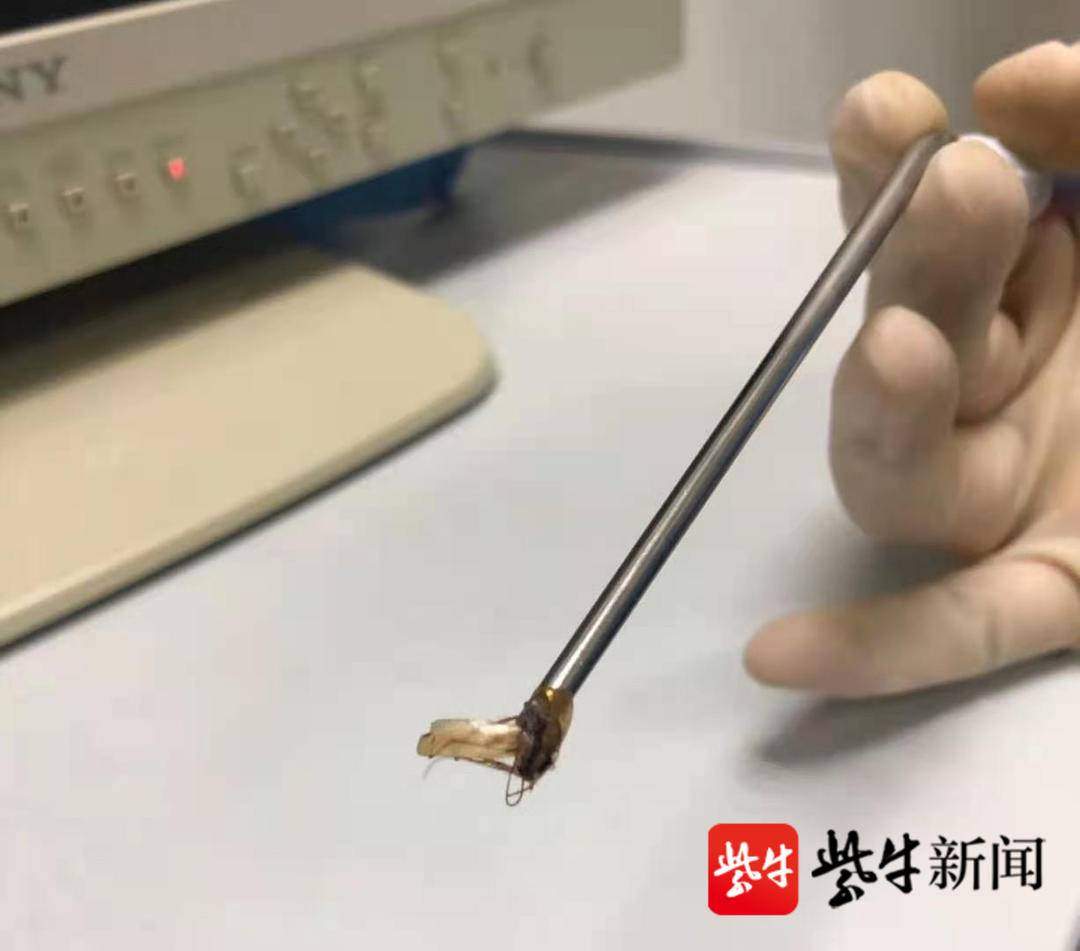 [VIDEO] Cockroach found inside woman's ears, snacking in bed the likely cause