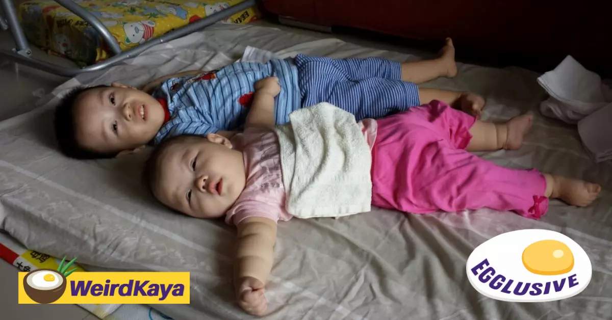 “Giving up isn’t an option” Read how Ng’s children overcame a rare genetic disorder