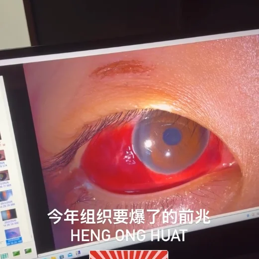 Hurt by firework debris ( )