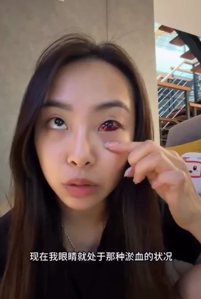 Hurt by firework debris ( )