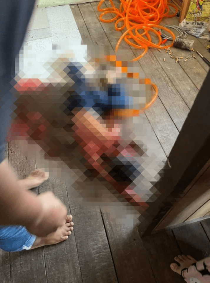 7yo boy who was attacked with hammer by uncle