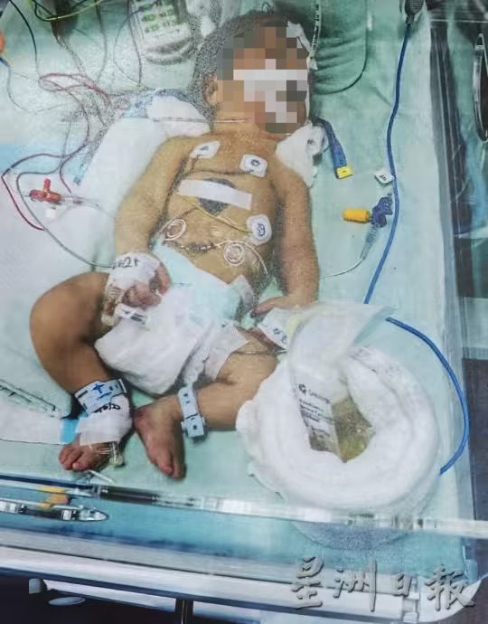 Delays lead to braindead baby (1)