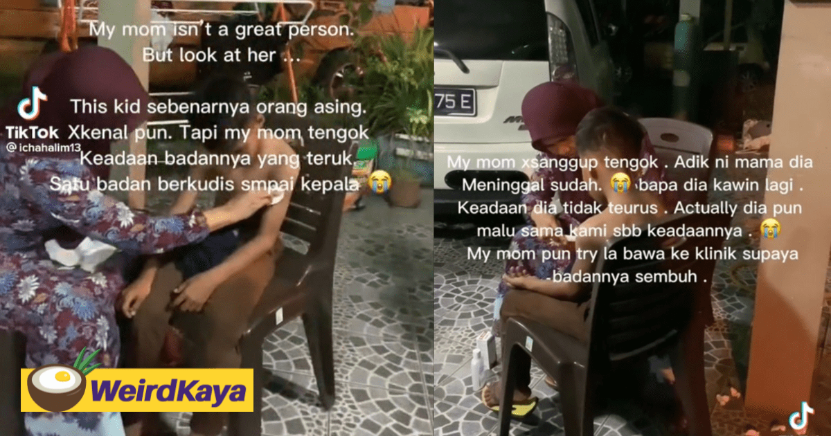 Woman Helps Boy With Scabies, Bring Him To A Clinic And Puts The Medication By Herself