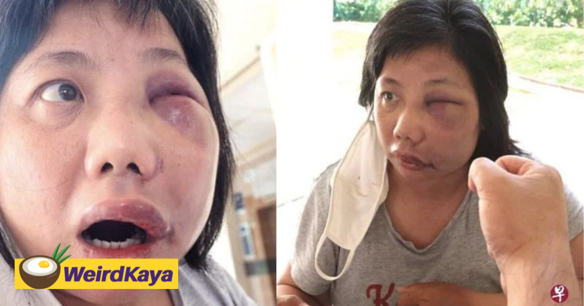 Woman punched 5 times by delivery rider after she yelled at him for driving recklessly | weirdkaya