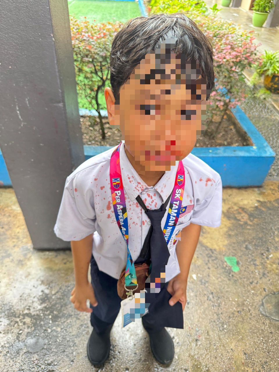 Boy injured by classmate's slap