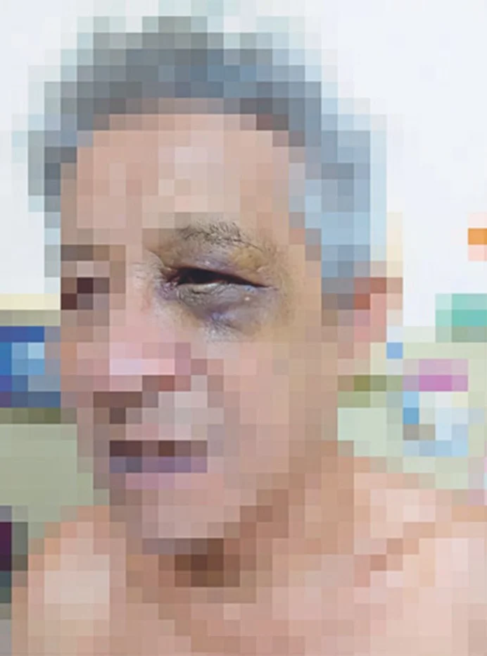 Cheras road rage victim Liew (2)