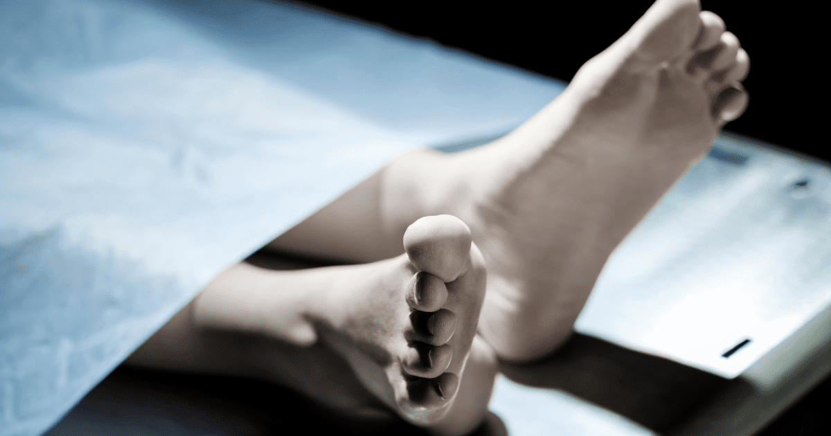 death body