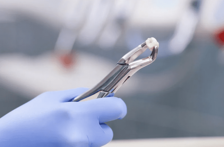 Dentist removing teeth