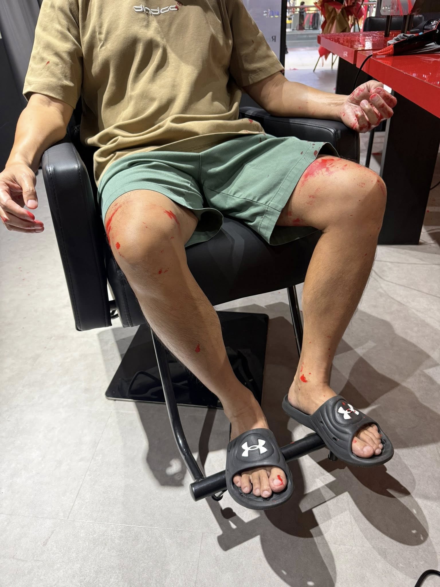 Douglas Ang's leg with red paint