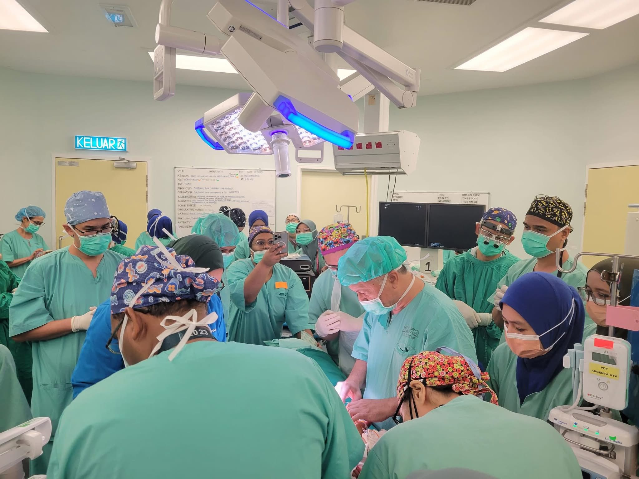 HTA 3Mo Conjoined Twins 1