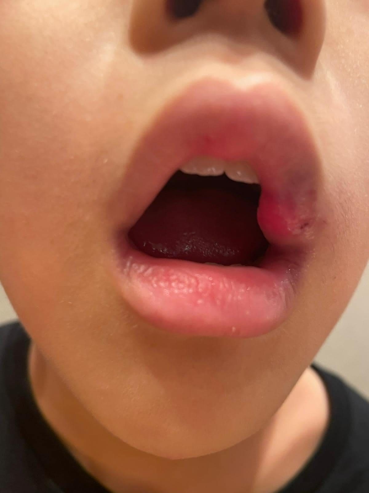 Chinese boy bullied by classmates at Canadian International School 