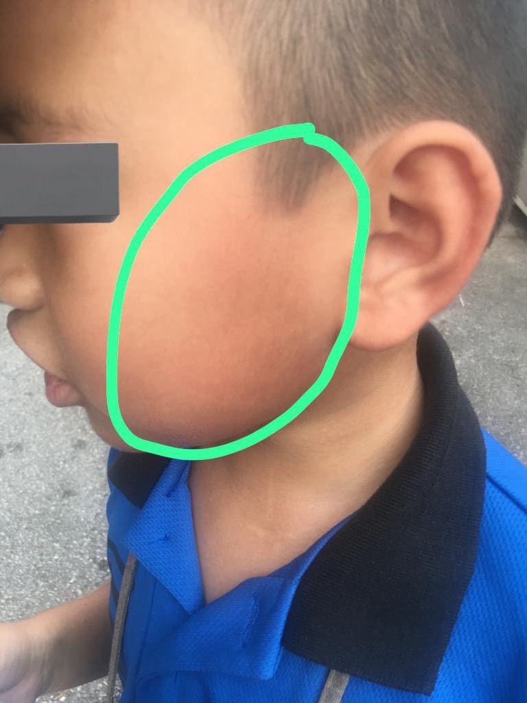 7yo M'sian Student Allegedly Slapped By Teacher For Not Being Able To Find Letter Inside SchoolbagÂ