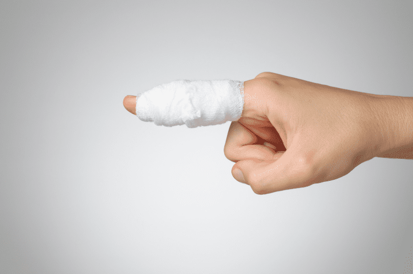 Injured finger