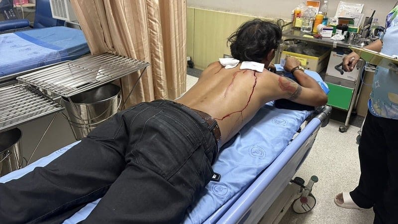 Injured Thai security guard