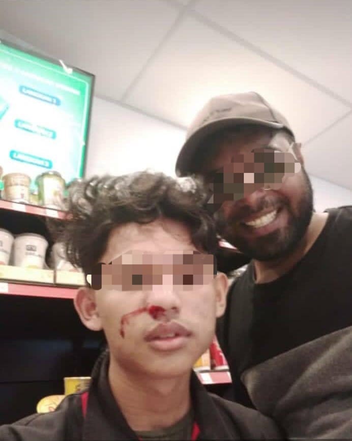 Drunk M'sian Man Punches Teen At Convenience Store, Friend Poses For A Selfie With Victim
