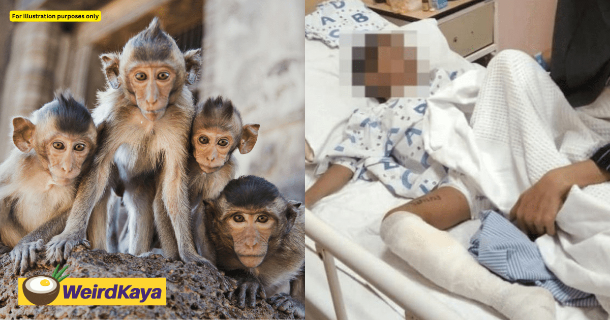 5yo M’sian Boy Attacked By Over 30 Monkeys, Receives 30 Stitches