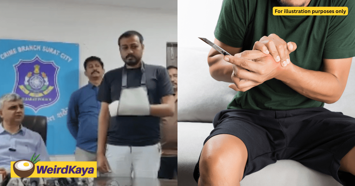 Man Chops Off 4 Of His Fingers As He Was Scared To Tell Boss He Wanted To Resign