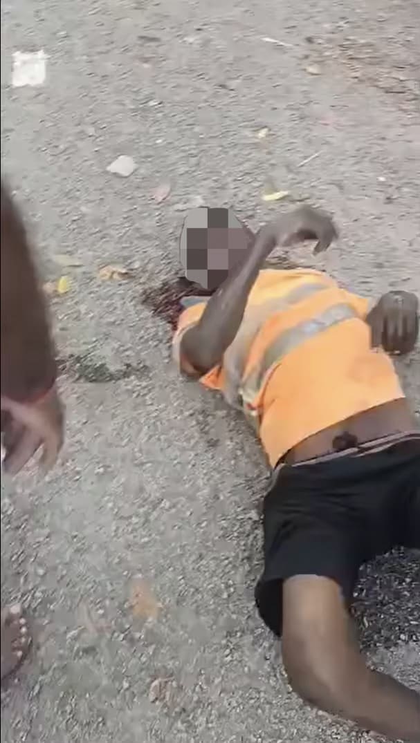 Man's eyeball gets gouged out