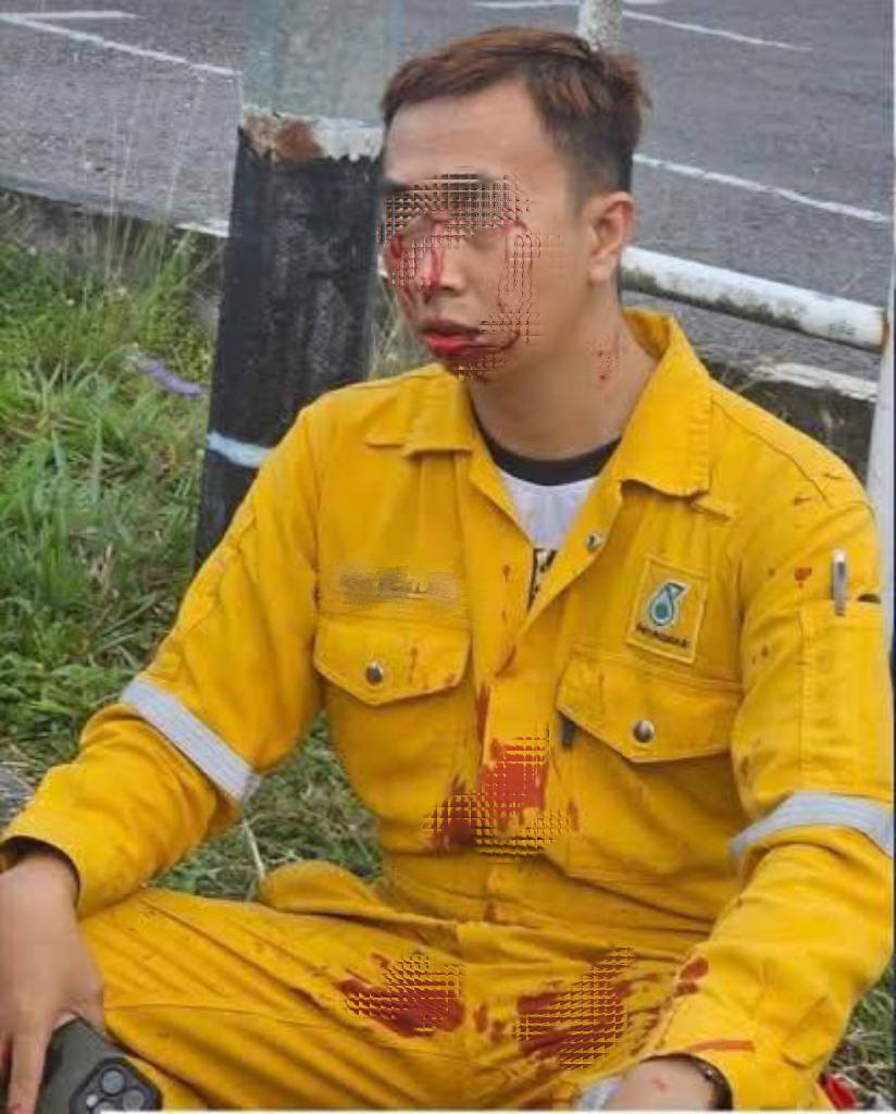 motorcyclist nearly loses eyes glass coated kite string body