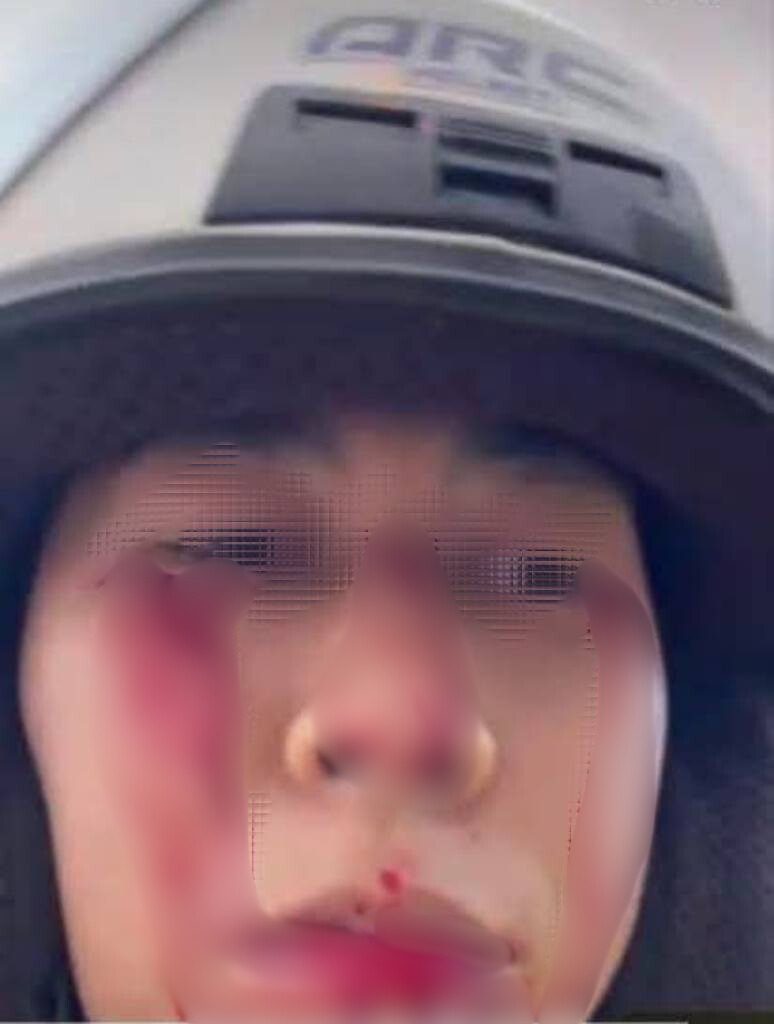 motorcyclist nearly loses eyes glass coated kite string face - Edited