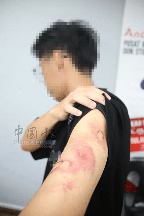 M'sian teen shows his bruises