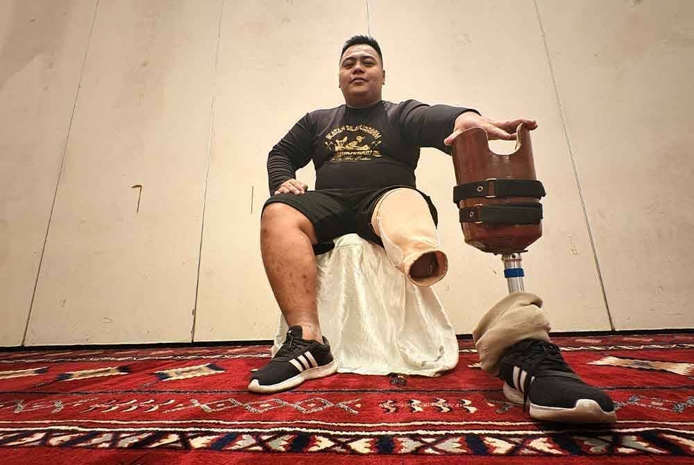 Muhammad Azizi posing with his prosthetic leg