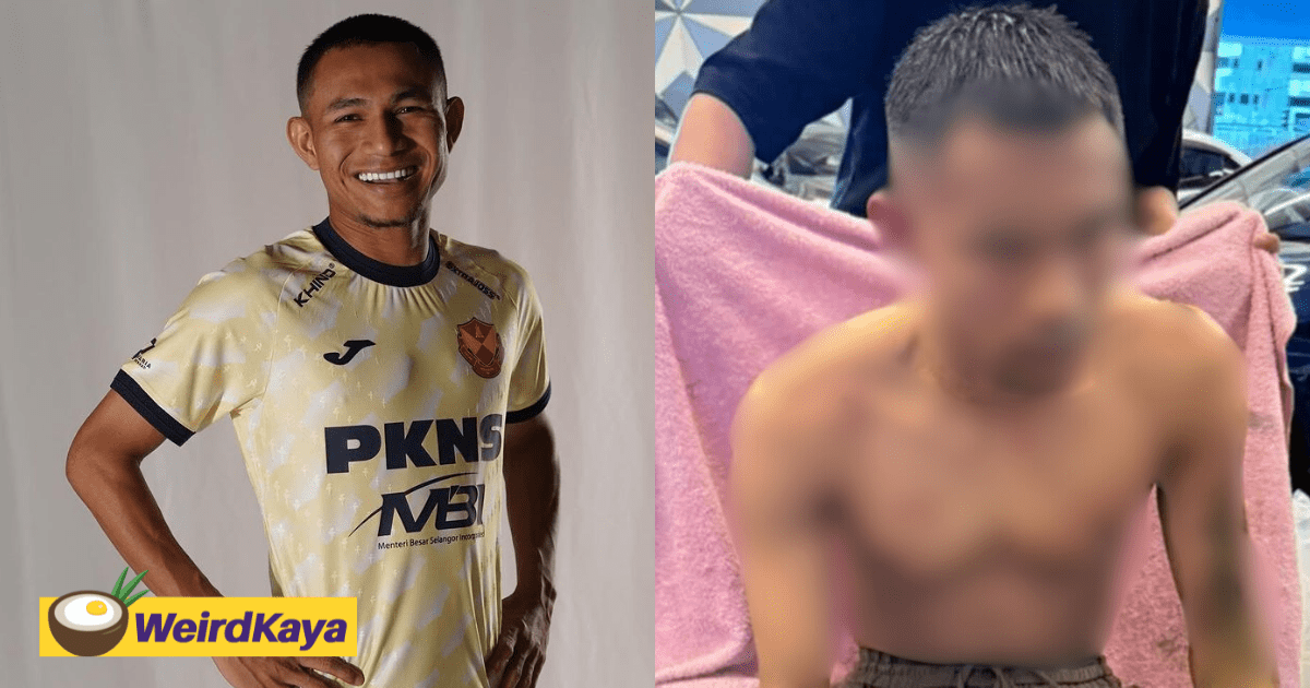 National Football Player Faisal Halim Suffers Acid Attack In A Shopping Mall