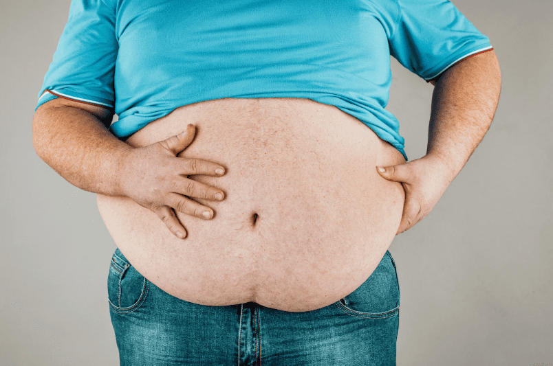 Obese man