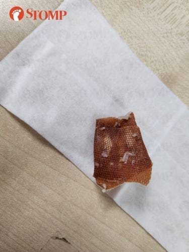 Plaster found inside vegetarian bee hoon