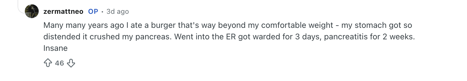 S’porean Competitive Eater Hospitalised After Stomach Swelled & Pressed On Organs