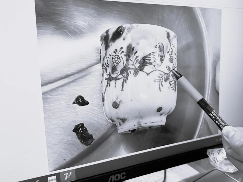 The ceramic cup in the patient's butt