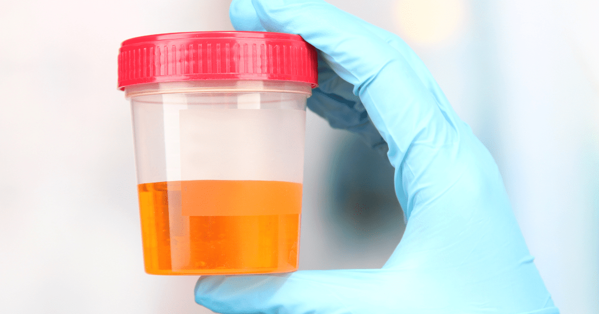 urine in test tube