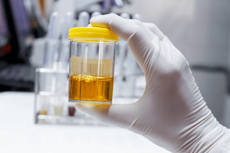 urine test