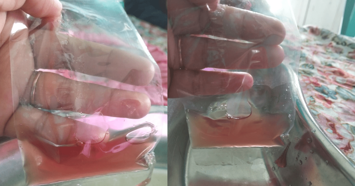 Woman shows blood in child's urine