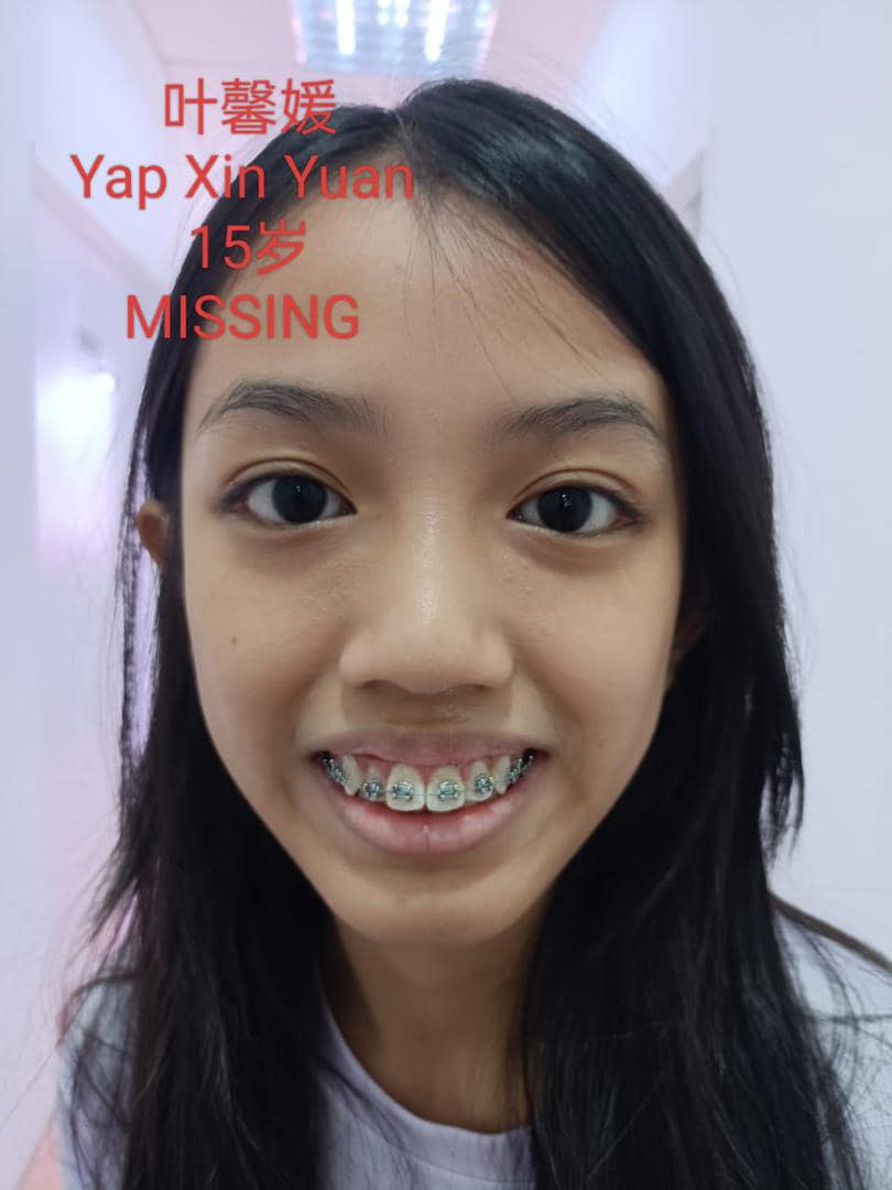Yap Xin Yuan